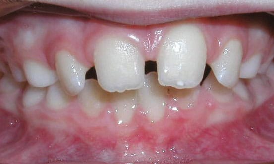 Spacing Becker and Scott Orthodontics in Springfield, MO