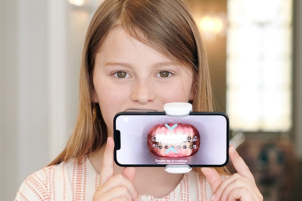 Dental Monitoring Becker and Scott Orthodontics in Springfield, MO